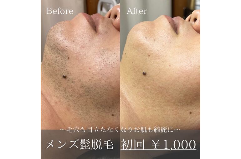 7EC87685-4369-4DBD-A0FB-DAE429D2D3E7