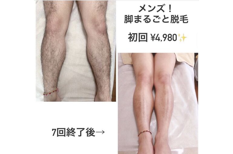 54BF4218-1476-47B7-B11C-33FE88370320